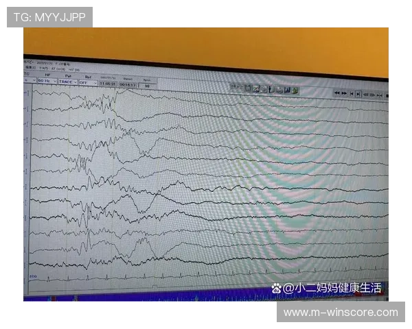 脑电波监测设备验证观赛兴奋度